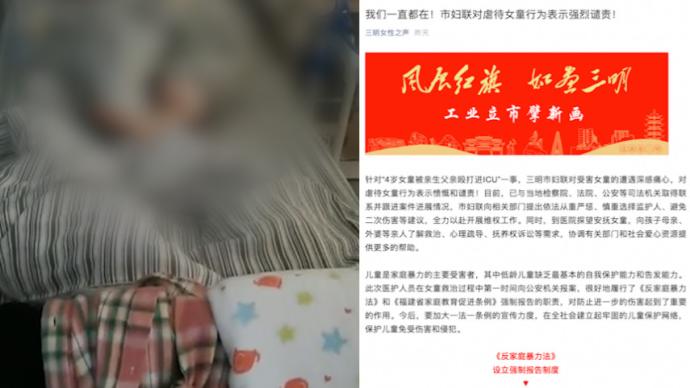 4岁女童遭生父殴打致肠破裂,当地妇联介入