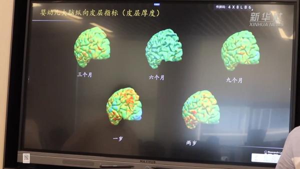 国产科研大装备赋能中国脑计划